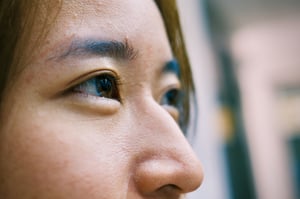 The eyes